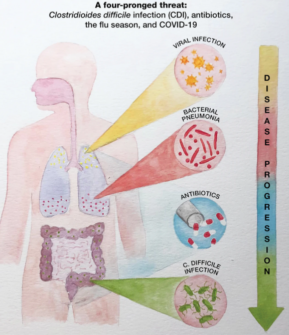 Infectious Disease Graphic